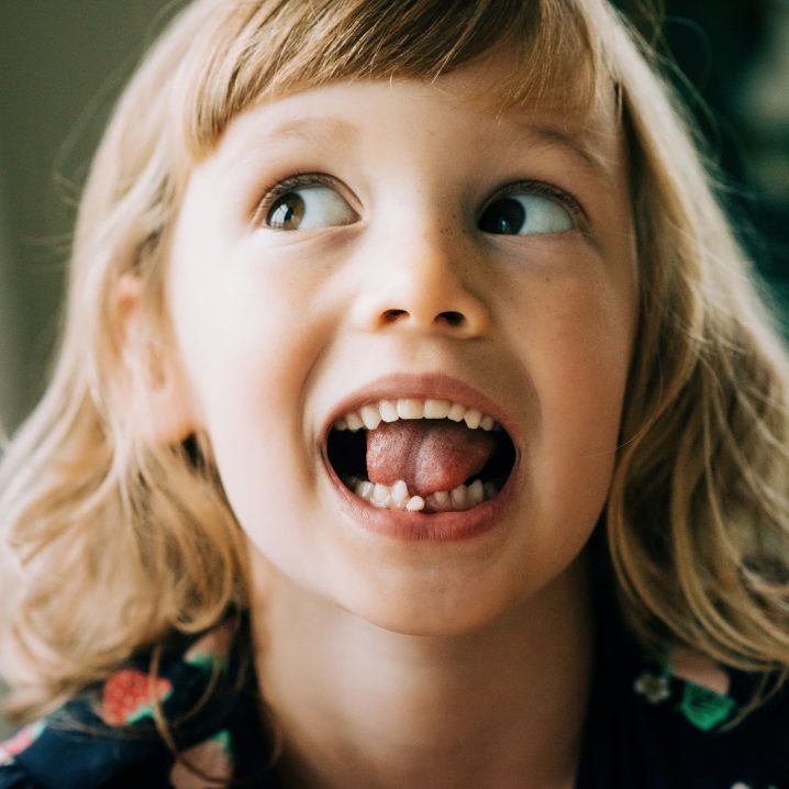 If Your Kid Swallows a Baby Tooth, It’s Probably No Big Deal - Here’s ...