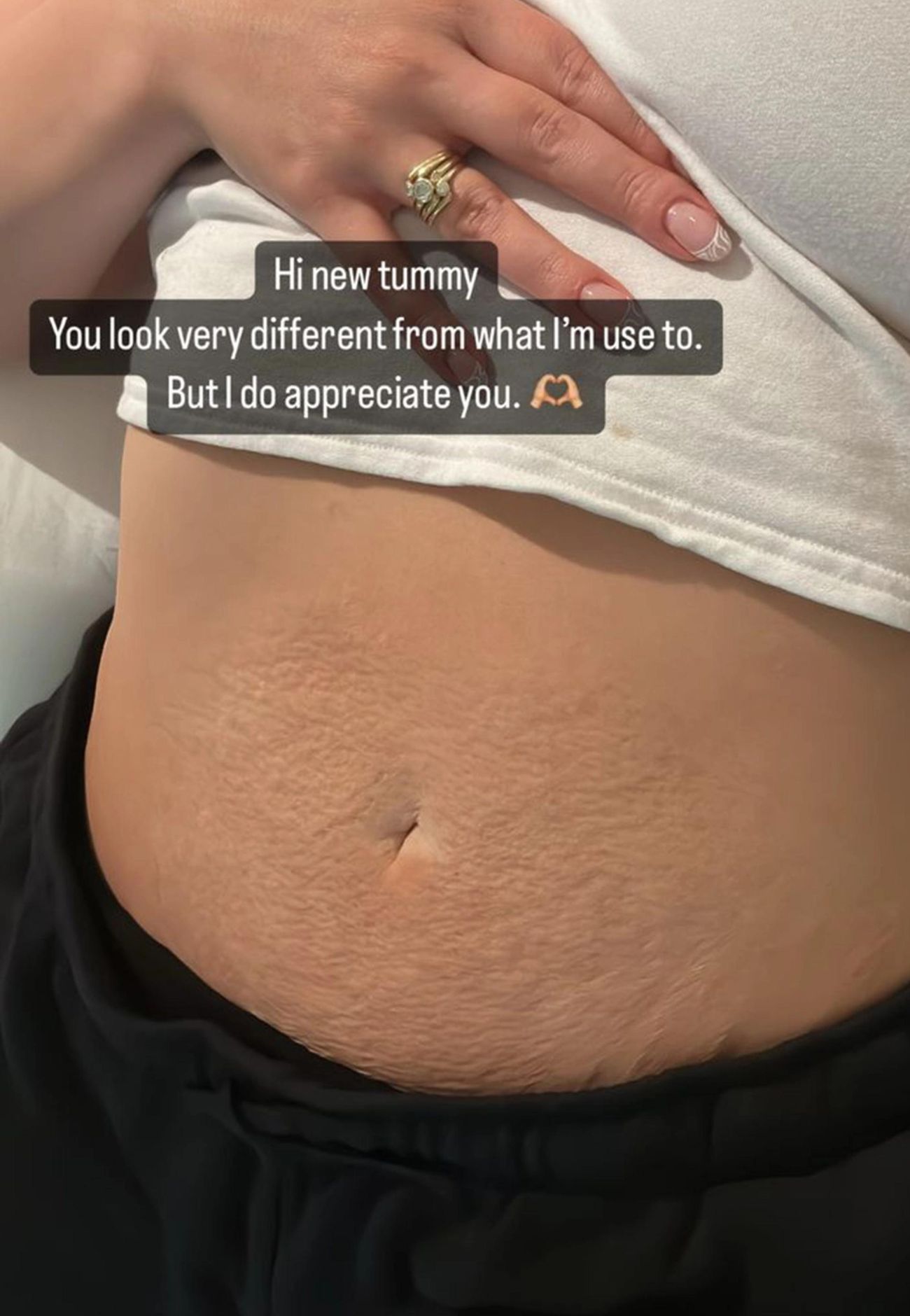 Ashley Graham Shares Her Very Different Postpartum Tummy in New Selfie -  POPSUGAR Australia